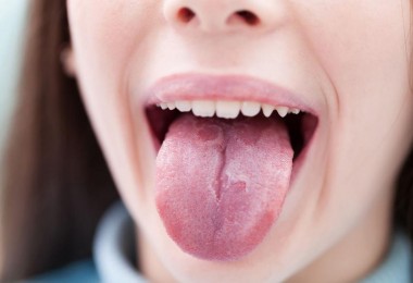 Белый налет на языке: причины появления и способы лечения, профилактики