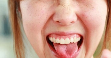 Белый прыщик на языке (у ребенка, у взрослого): причины и лечение